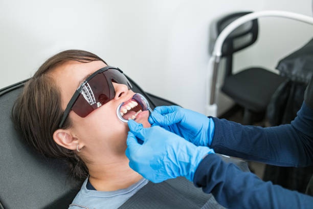 Best Chipped Tooth Repair Near Me  in Claremont, CA